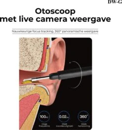 P40 - Oorsmeer Verwijderaar Met Camera - Oorreiniger Met Camera - Earcleaner - Camerabeeld Op Je Smartphone - Otoscoop -Zelfzorg Winkel 1128x1200 1