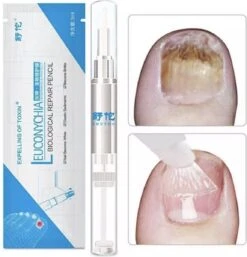 Nagelbehandeling Behandeling - 7 Dagen - Serum - Voet/hand - Kalk/schimmelnagel 7 Nagelbehandeling Behandeling - 7 Dagen - Serum - Voet/hand - Kalk/schimmelnagel -Zelfzorg Winkel 1152x1200 5