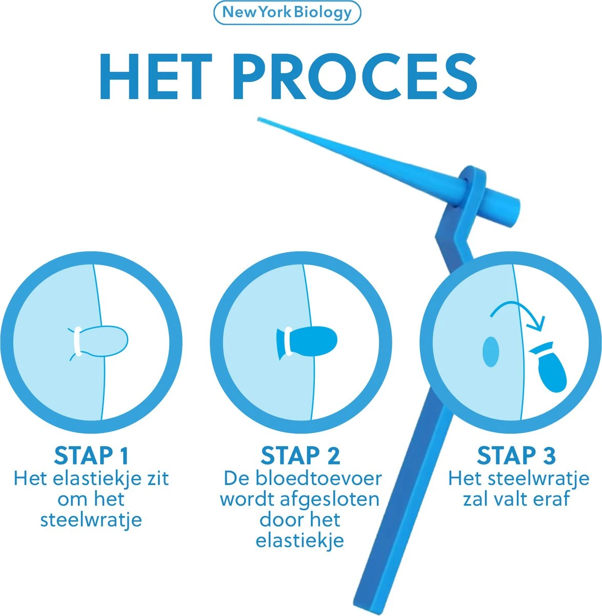 New York Biology - Steelwratjes Verwijderaar - Steelwratten Verijden Snel En Zonder Pijn 6 New York Biology - Steelwratjes Verwijderaar - Steelwratten Verijden Snel En Zonder Pijn - Afbeelding 4