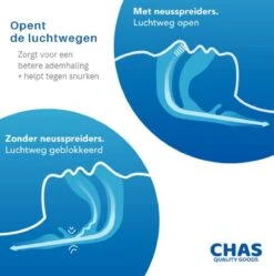 Anti Snurk – Anti Snore - Comfortabel - Onzichtbaar - Snurken - Stoppen Met Snurken - Neus Spreider - Nose Clips - Set Van 4 Stuks - GRATIS Opbergdoos 15 Anti Snurk – Anti Snore - Comfortabel - Onzichtbaar - Snurken - Stoppen Met Snurken - Neus Spreider - Nose Clips - Set Van 4 Stuks - GRATIS Opbergdoos -Zelfzorg Winkel 1189x1200 1