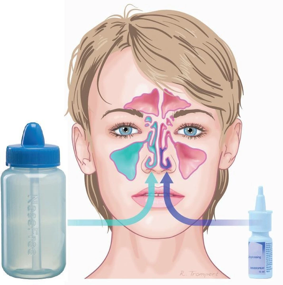 NasoFree® Neusdouche Startset Met 30 Zakjes Nasaal Spoelzout 6 NasoFree® Neusdouche Startset Met 30 Zakjes Nasaal Spoelzout - Afbeelding 4