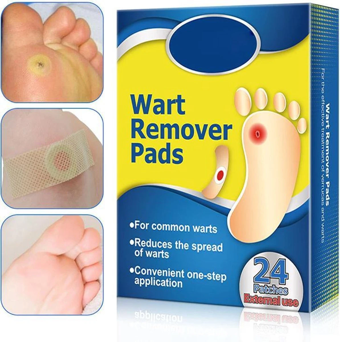 Wratten Pleisters 3 Wratten Pleisters