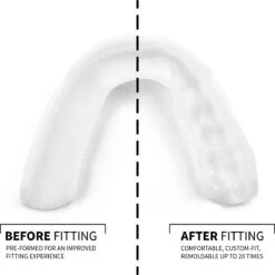 SOVA Aero Tandenknarsbitje (3D Voorgevormd) - Nog Makkelijker Te Vormen. Nieuwe Versie 2022 -Zelfzorg Winkel 1198x1200 3