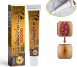 Aambeienzalf Met Natuurlijke Ingrediënten / Pijn & Zwelling Verminderend + Verkoelend Effect / Aambeien Creme 10 Aambeienzalf Met Natuurlijke Ingrediënten / Pijn & Zwelling Verminderend + Verkoelend Effect / Aambeien Creme -Zelfzorg Winkel 1200x1050