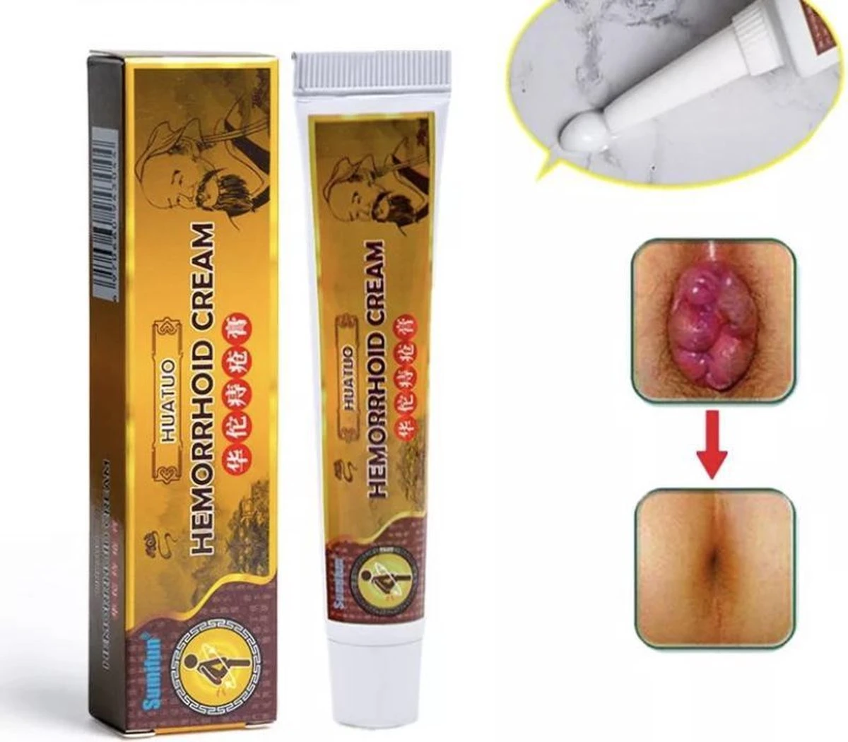 Aambeienzalf Met Natuurlijke Ingrediënten / Pijn & Zwelling Verminderend + Verkoelend Effect / Aambeien Creme 6 Aambeienzalf Met Natuurlijke Ingrediënten / Pijn & Zwelling Verminderend + Verkoelend Effect / Aambeien Creme - Afbeelding 4