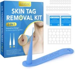 Steelwratjes Verwijderen - Steelwratten Verwijderaar - Skin Tags Verwijderen - Moedervlekken Verwijderaar - Wrattenverwijderaar - Steelwratjes Thuiskit - Voor Klein En Groot 2-8mm! -Zelfzorg Winkel 1200x1103 5