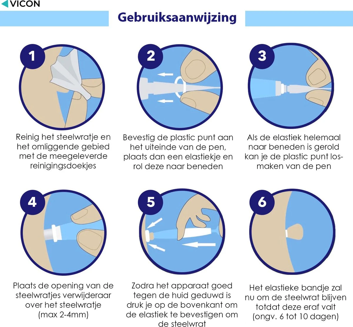 Vicon Steelwratjes Verwijderen - 2-5MM - Pijnloos En Snel - Incl. Huidpleisters - Skin Tags Verwijderen - Wrattenverwijderaar - Steelwratten Pen 6 Vicon Steelwratjes Verwijderen - 2-5MM - Pijnloos En Snel - Incl. Huidpleisters - Skin Tags Verwijderen - Wrattenverwijderaar - Steelwratten Pen - Afbeelding 4