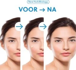 New York Biology - Steelwratjes Verwijderaar - Steelwratten Verijden Snel En Zonder Pijn 15 New York Biology - Steelwratjes Verwijderaar - Steelwratten Verijden Snel En Zonder Pijn -Zelfzorg Winkel 1200x1118 1