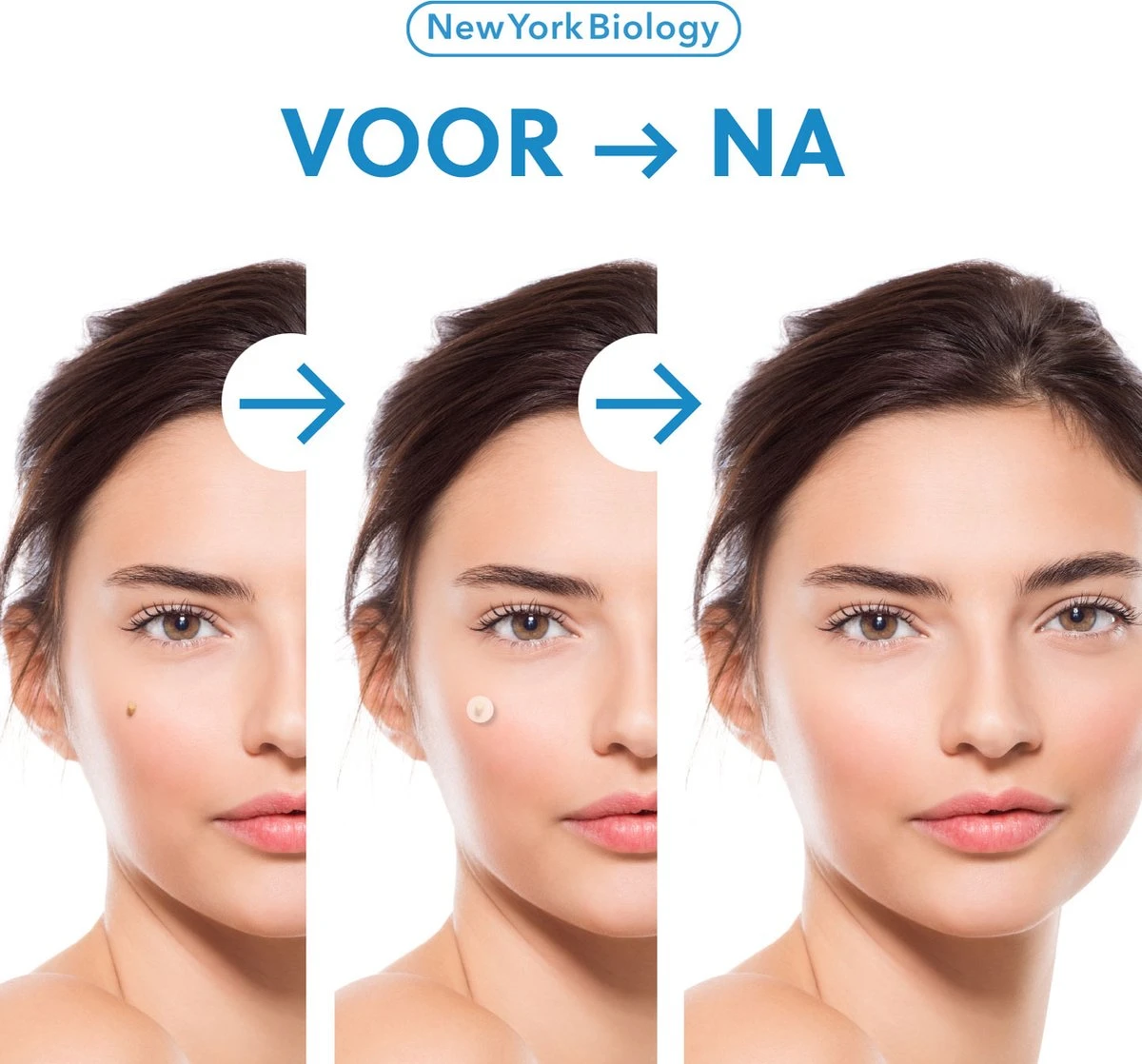 New York Biology - Steelwratjes Verwijderaar - Steelwratten Verijden Snel En Zonder Pijn 9 New York Biology - Steelwratjes Verwijderaar - Steelwratten Verijden Snel En Zonder Pijn - Afbeelding 7