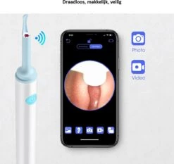 SFproducts Oorsmeer Verwijderaar - Oorreiniger- Schone Oren- Otoscoop- Oorsmeer Verwijderaar Elektrisch- Veilig Met App- Oorreiniger Met Camera -Zelfzorg Winkel 1200x1131