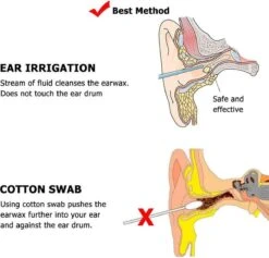 Merkloos Oorreiniger / Oorspuit - Vernieuwde Oorsmeer Verwijderaar Met Spuit - Ear Cleaner -Zelfzorg Winkel 1200x1152 1