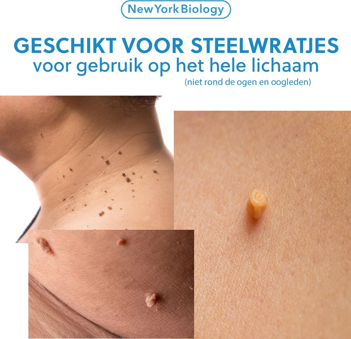 New York Biology - Steelwratjes Verwijderaar - Steelwratten Verijden Snel En Zonder Pijn 8 New York Biology - Steelwratjes Verwijderaar - Steelwratten Verijden Snel En Zonder Pijn - Afbeelding 6