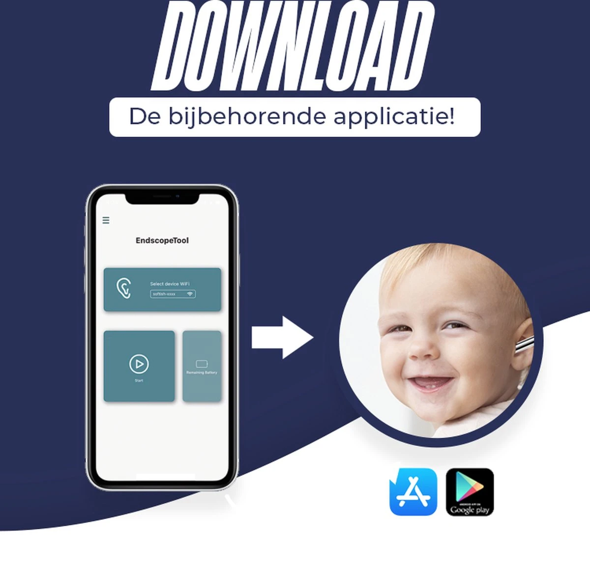 Professionele Oorsmeer Verwijderaar - Uitgebreide Set - Met Camera - En App - Oor Reiniger - Oorreiniger - Otoscoop - Ear Wax Cleaner - Oren Schoonmaken - Oorreiniger - Oorreiniger Oorsmeer Verwijderaar - Cadeau Voor Man - Sinterklaas Cadeautjes 8 Professionele Oorsmeer Verwijderaar - Uitgebreide Set - Met Camera - En App - Oor Reiniger - Oorreiniger - Otoscoop - Ear Wax Cleaner - Oren Schoonmaken - Oorreiniger - Oorreiniger Oorsmeer Verwijderaar - Cadeau Voor Man - Sinterklaas Cadeautjes - Afbeelding 6