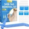 Steelwratjes Verwijderen - Steelwratten Verwijderaar - Skin Tags Verwijderen - Moedervlekken Verwijderaar - Wrattenverwijderaar - Steelwratjes Thuiskit - Voor Klein En Groot 2-8mm! -Zelfzorg Winkel 1200x1166 8