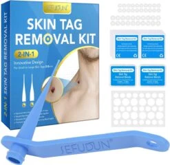 Steelwratjes Verwijderen - Steelwratten Verwijderaar - Skin Tags Verwijderen - Moedervlekken Verwijderaar - Wrattenverwijderaar - Steelwratjes Thuiskit - Voor Klein En Groot 2-8mm!