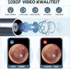 ESSIBLE Oorsmeer Verwijderaar - Oren Schoonmaken - Wifi Oorcamera -Zelfzorg Winkel 1200x1177