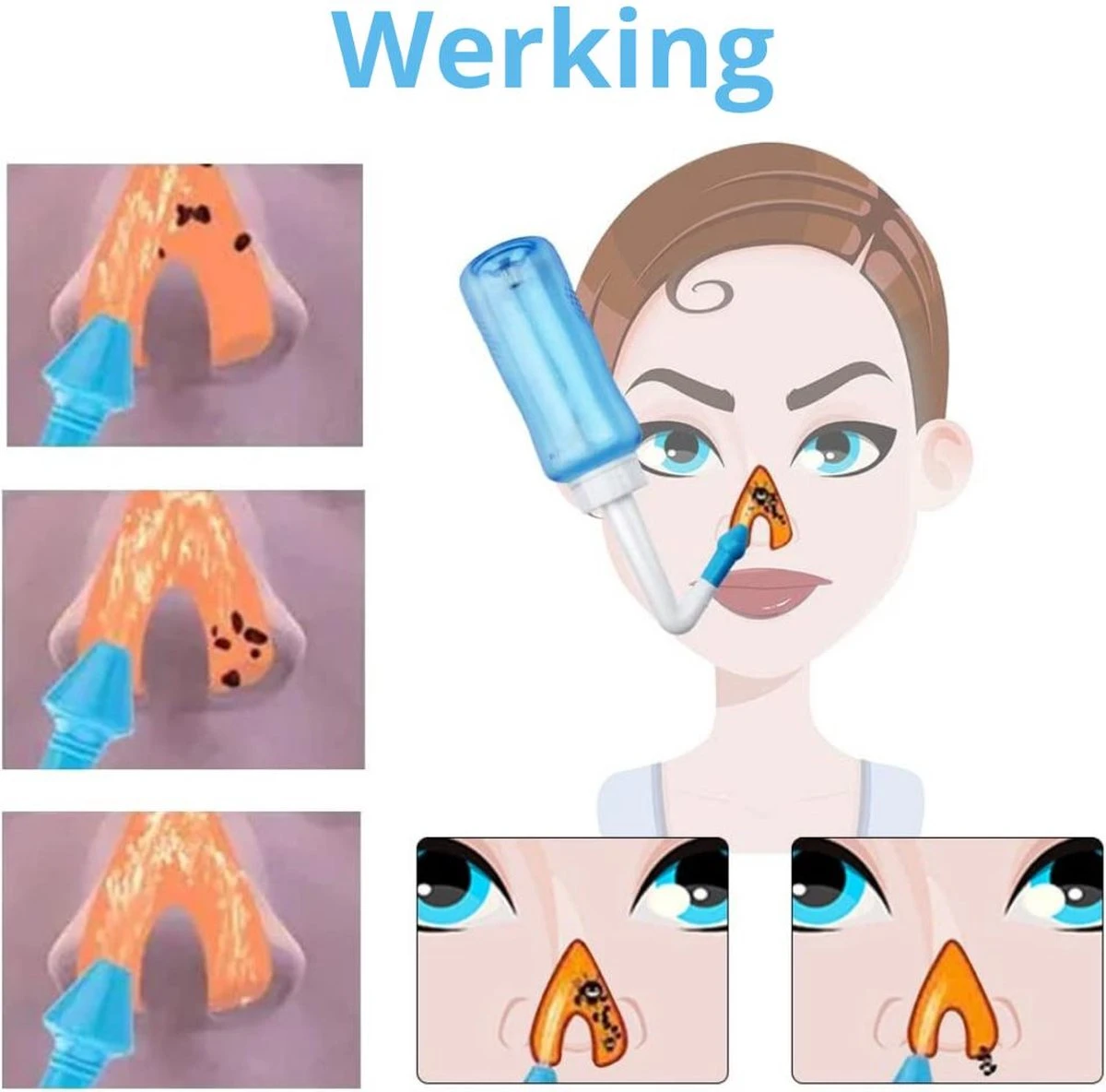 Waterpulse Neusdouche - Neusspoeler – Neusreiniger- 300ml - Tegen Hooikoorts – Bij Verstopte Neus – Bij Verkoudheid- Voor Volwassenen En Kinderen - Neusreiniger 2023 9 Waterpulse Neusdouche - Neusspoeler – Neusreiniger- 300ml - Tegen Hooikoorts – Bij Verstopte Neus – Bij Verkoudheid- Voor Volwassenen En Kinderen - Neusreiniger 2023 - Afbeelding 7