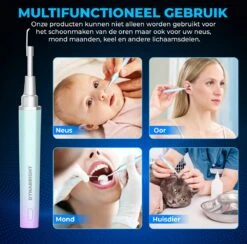 DynaBright Oorsmeer Verwijderaar - Oorreiniger - Met Camera - Deksel (dopje) Voor Extra Hygiëne - Verbind Via WiFi - Ear Cleaner - Met LedLamp En App Op Smartphone - Verwisselbare Opzetstukjes 17 DynaBright Oorsmeer Verwijderaar - Oorreiniger - Met Camera - Deksel (dopje) Voor Extra Hygiëne - Verbind Via WiFi - Ear Cleaner - Met LedLamp En App Op Smartphone - Verwisselbare Opzetstukjes -Zelfzorg Winkel 1200x1187 2