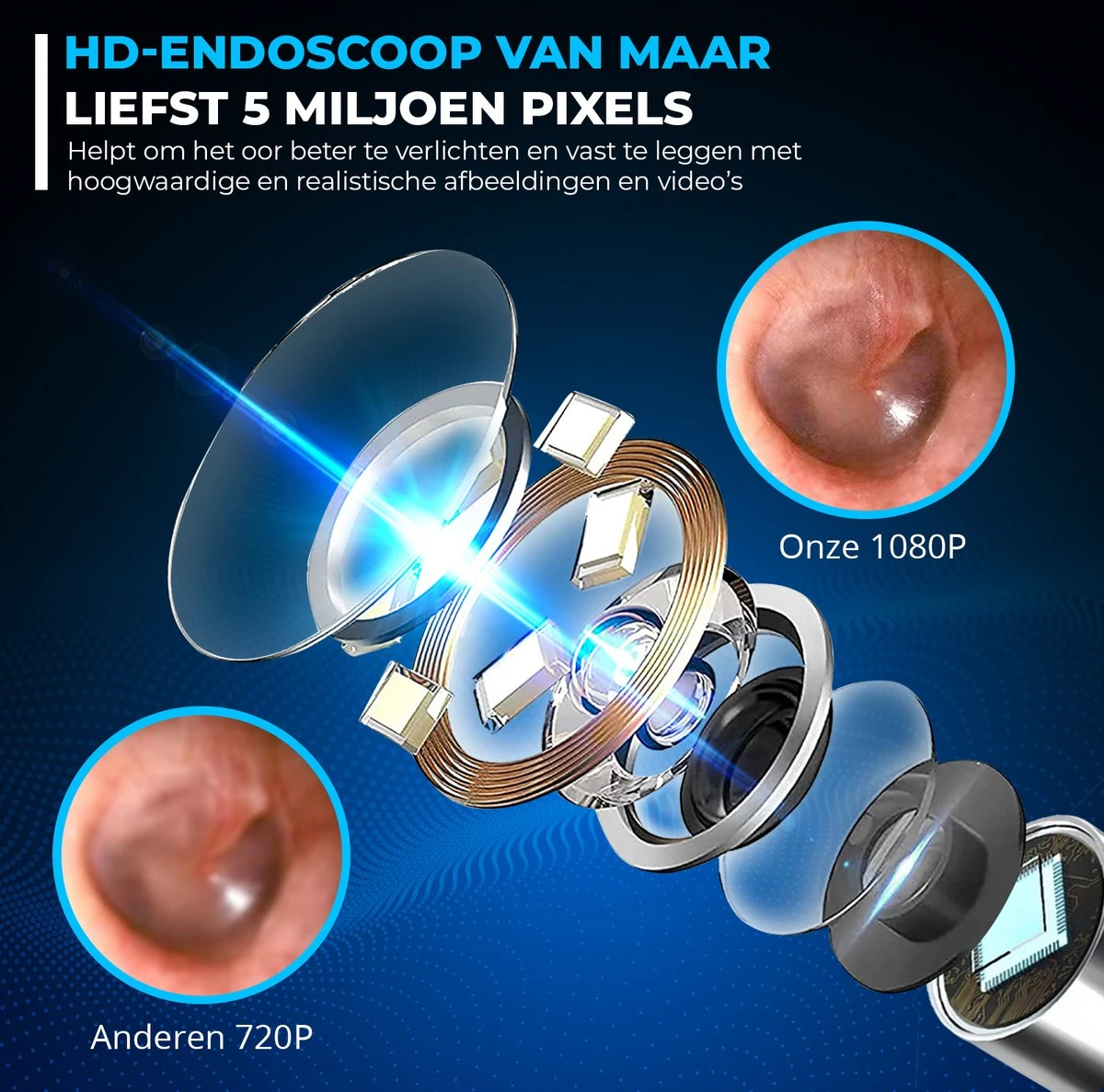 DynaBright Oorsmeer Verwijderaar - Oorreiniger - Met Camera - Deksel (dopje) Voor Extra Hygiëne - Verbind Via WiFi - Ear Cleaner - Met LedLamp En App Op Smartphone - Verwisselbare Opzetstukjes 11 DynaBright Oorsmeer Verwijderaar - Oorreiniger - Met Camera - Deksel (dopje) Voor Extra Hygiëne - Verbind Via WiFi - Ear Cleaner - Met LedLamp En App Op Smartphone - Verwisselbare Opzetstukjes - Afbeelding 9