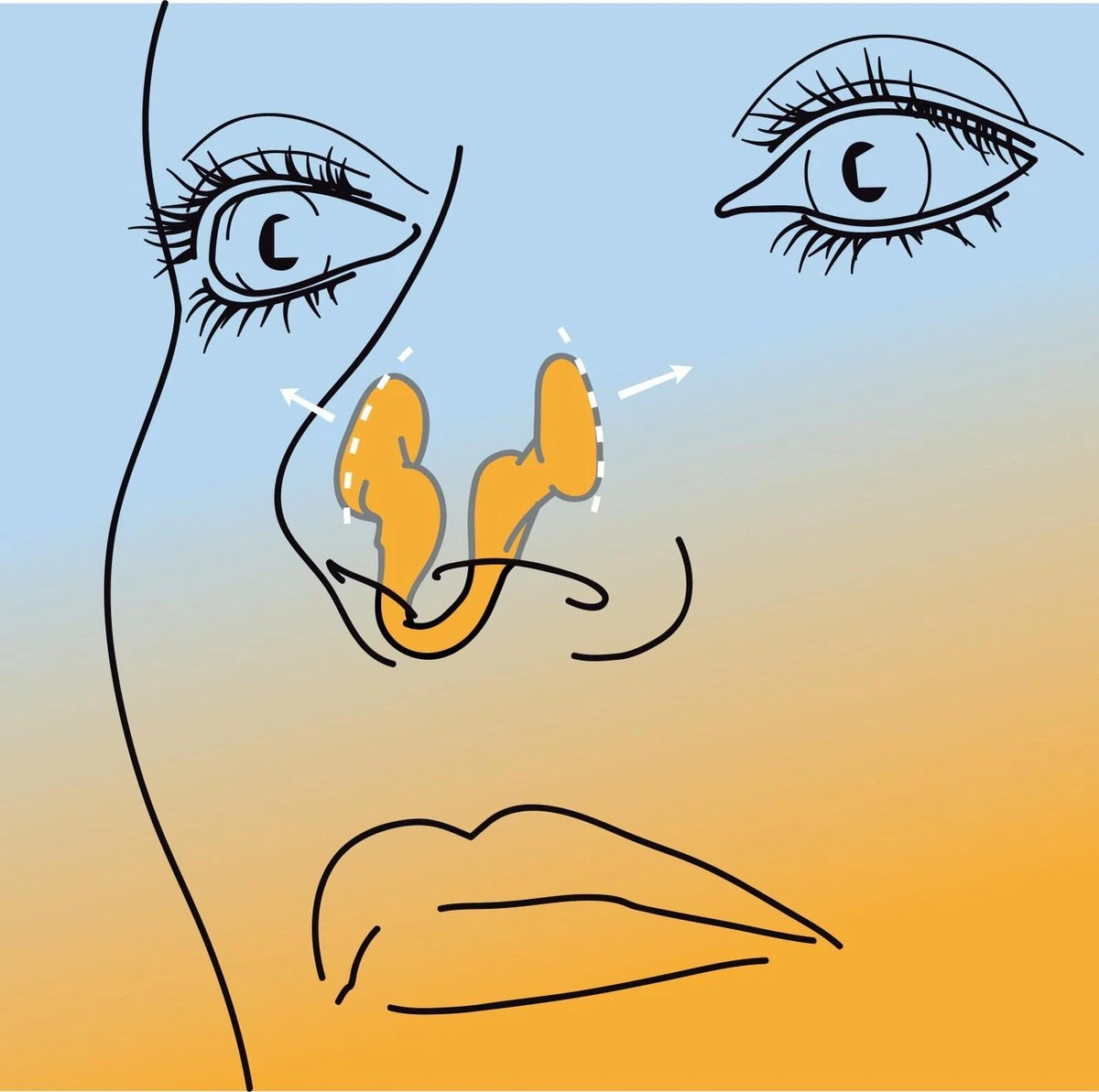 2 Verpakkingen Airmax Neusspreider Vermindert Snurken En Ter Verbetering Van De Neusademhaling, Small 2 Stuks. 4 2 Verpakkingen Airmax Neusspreider Vermindert Snurken En Ter Verbetering Van De Neusademhaling, Small 2 Stuks. - Afbeelding 2