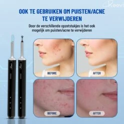 Reevi EarCleaner – 1 Jaar Garantie - Oorreiniger – Oorsmeer Verwijderaar – Mee Eters Verwijderen - Met Camera, Lamp En App Op Smartphone -Zelfzorg Winkel 1200x1199 3