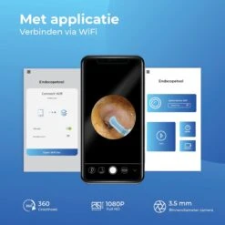 Oorsmeer Verwijderaar Met Camera – Oorreiniger – Ear Cleaner – WiFi – Wit 14 Oorsmeer Verwijderaar Met Camera – Oorreiniger – Ear Cleaner – WiFi – Wit -Zelfzorg Winkel 1200x1200 148