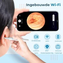 Westhome Oorsmeer Verwijderaar Met Camera- Oorreiniger - Met 6 Delige Set - Wifi - Wit 26 Westhome Oorsmeer Verwijderaar Met Camera- Oorreiniger - Met 6 Delige Set - Wifi - Wit -Zelfzorg Winkel 1200x1200 162