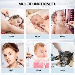 ESSIBLE Oorsmeer Verwijderaar - Oren Schoonmaken - Wifi Oorcamera -Zelfzorg Winkel 1200x1200 175