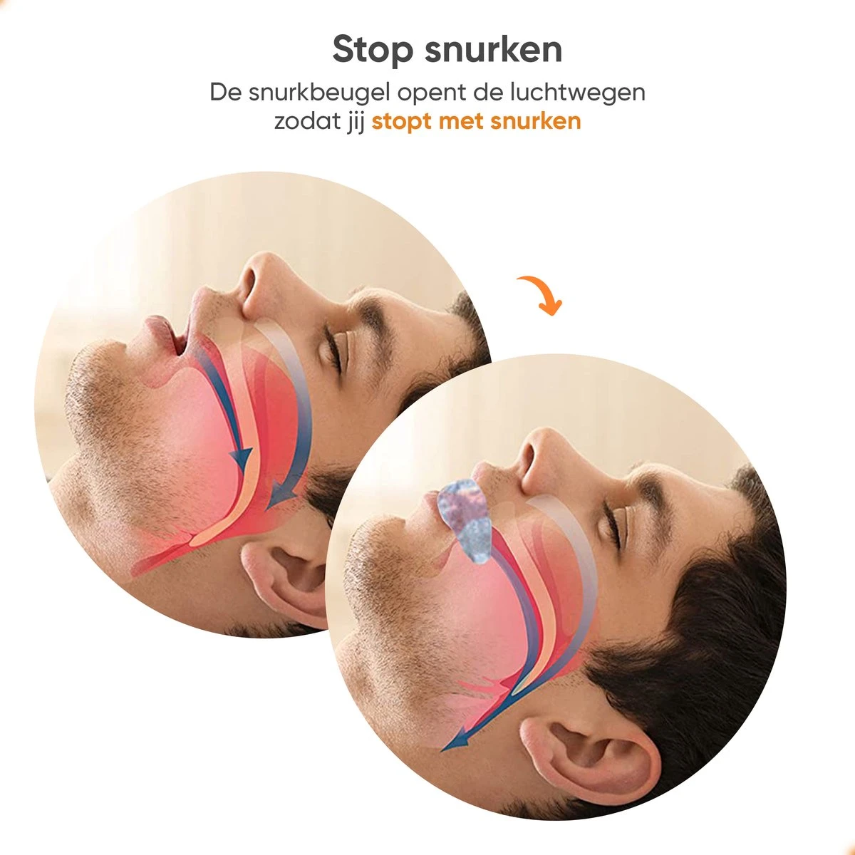 InSlaap Anti Snurk - Anti Snurk Beugel - Anti Snurk Producten - Snurkbeugels - Anti Snurk - Gebitsbeschermer - Anti Snurk Neusspreider - Neusspreider - Knarsbitje 6 InSlaap Anti Snurk - Anti Snurk Beugel - Anti Snurk Producten - Snurkbeugels - Anti Snurk - Gebitsbeschermer - Anti Snurk Neusspreider - Neusspreider - Knarsbitje - Afbeelding 4