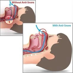 Anti Snurk Neusspreider 7 - 12 Dagen 7 Anti Snurk Neusspreider 7 - 12 Dagen -Zelfzorg Winkel 1200x1200 315