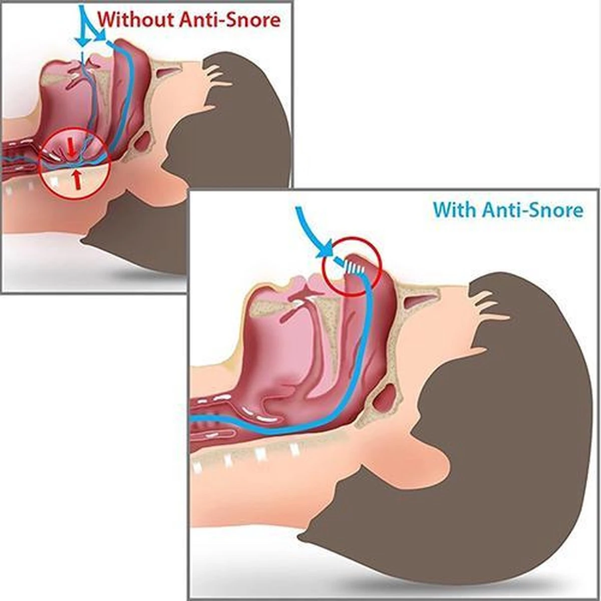 Anti Snurk Neusspreider 7 - 12 Dagen 5 Anti Snurk Neusspreider 7 - 12 Dagen - Afbeelding 3