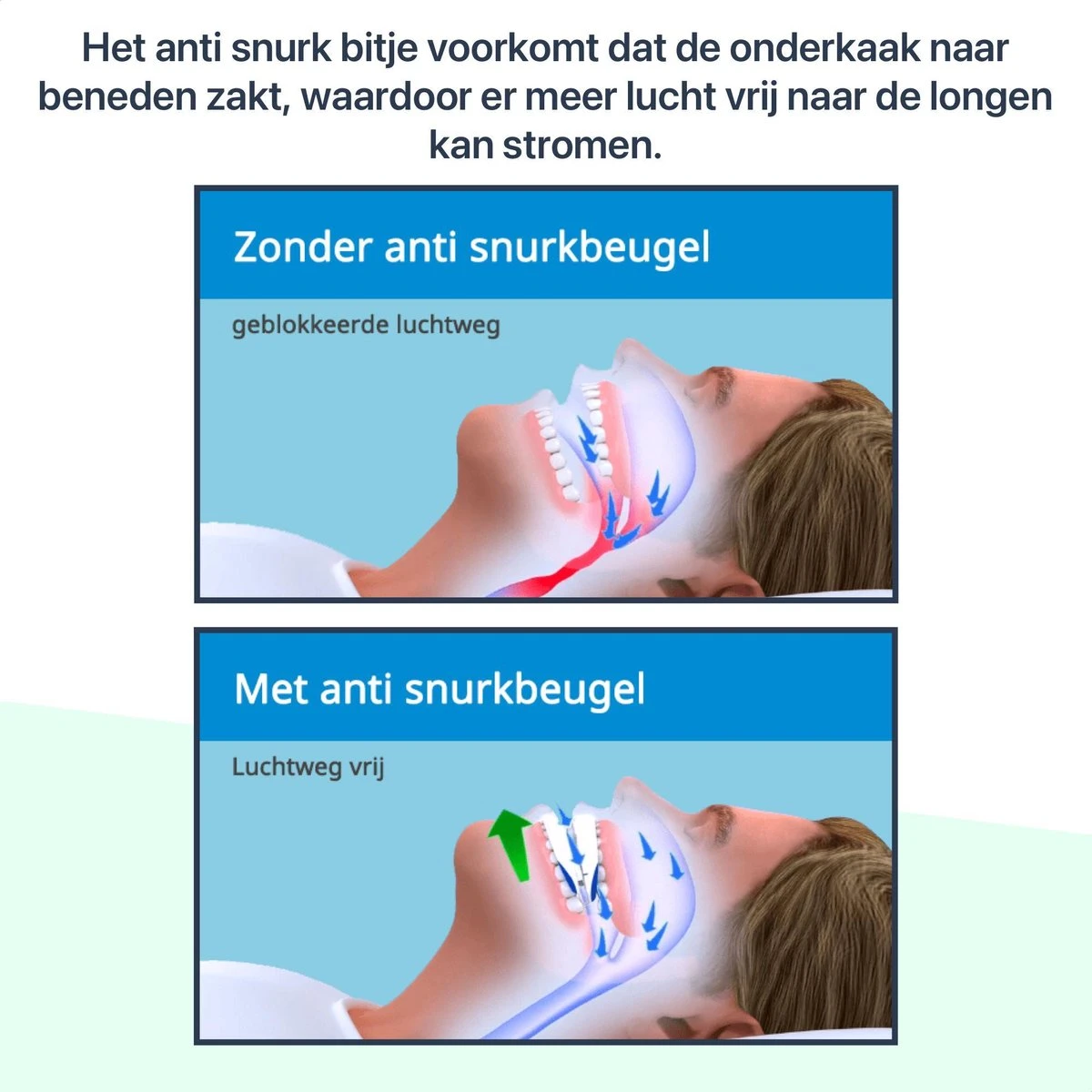 Anti Snurk Beugel Incl. Reinigingstabletten Bitje Antisnurk Snurken - Snurk Producten - Strips - Neusspreider - AntiSnurkDr® 6 Anti Snurk Beugel Incl. Reinigingstabletten Bitje Antisnurk Snurken - Snurk Producten - Strips - Neusspreider - AntiSnurkDr® - Afbeelding 4