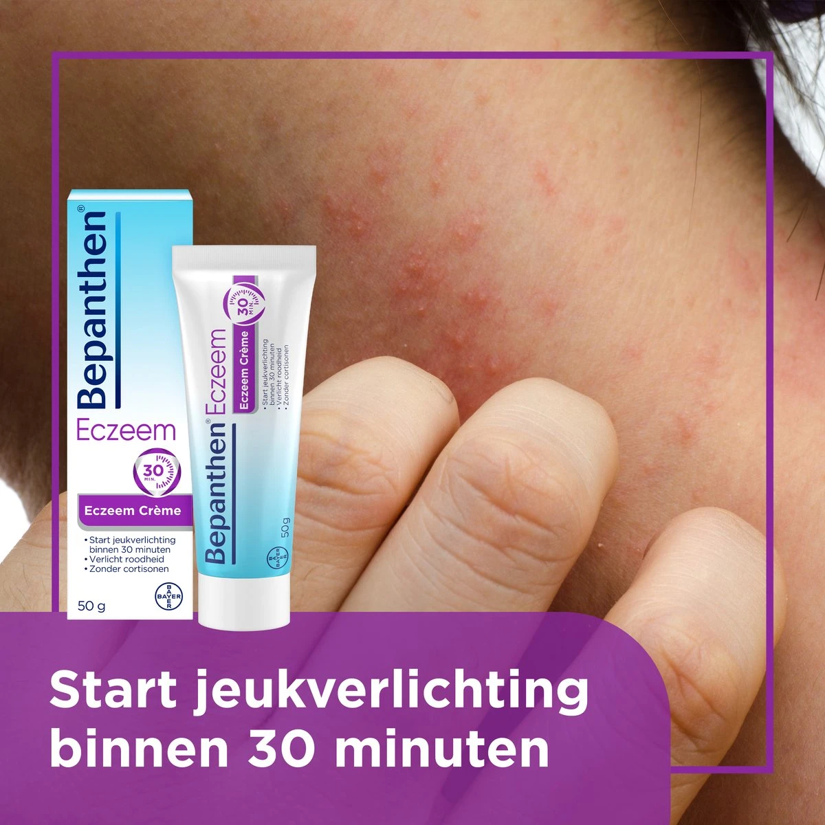 Bepanthen Eczeem Creme - Verlicht Jeuk En Roodheid - Mild Tot Matig Atopisch Eczeem - 50 Gram 6 Bepanthen Eczeem Creme - Verlicht Jeuk En Roodheid - Mild Tot Matig Atopisch Eczeem - 50 Gram - Afbeelding 4