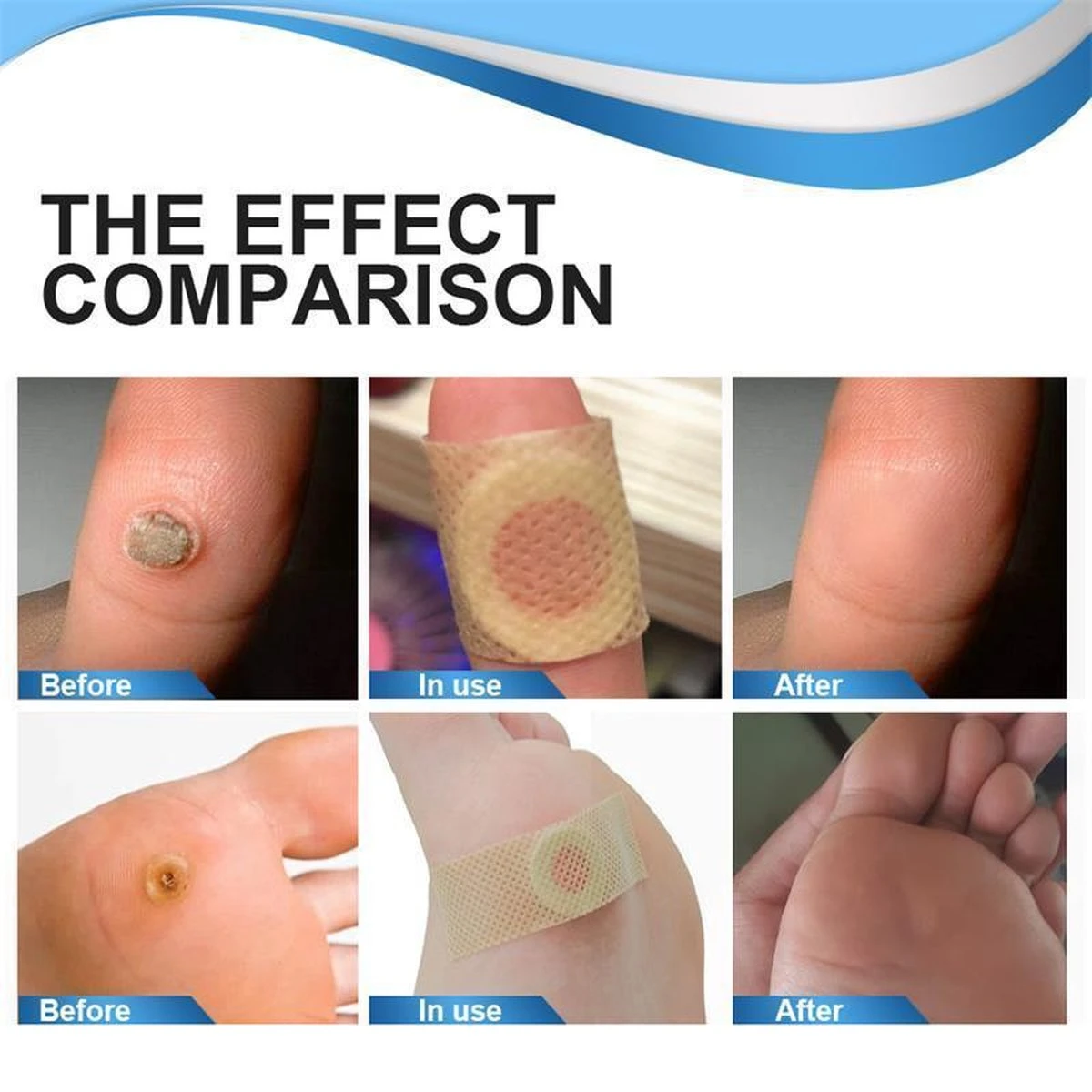 Wratten Pleisters 7 Wratten Pleisters - Afbeelding 5