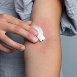 Gladskin ECZEMACT Cream 15ml - Klinisch Bewezen Effectief Tegen Jeuk , Roodheid En Schilfers - Hydrateert Extreem Droge Huid - Met Staphefekt™ -Zelfzorg Winkel 1200x1200 535