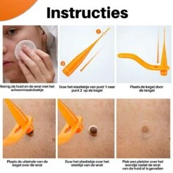 JT Beauty Care Steelwratjes Thuiskit - Steelwratjes Verwijderen - 2-7 Mm - Skin Tags - Gemakkelijk, Snel En Pijnloos -Zelfzorg Winkel 1200x1200 549