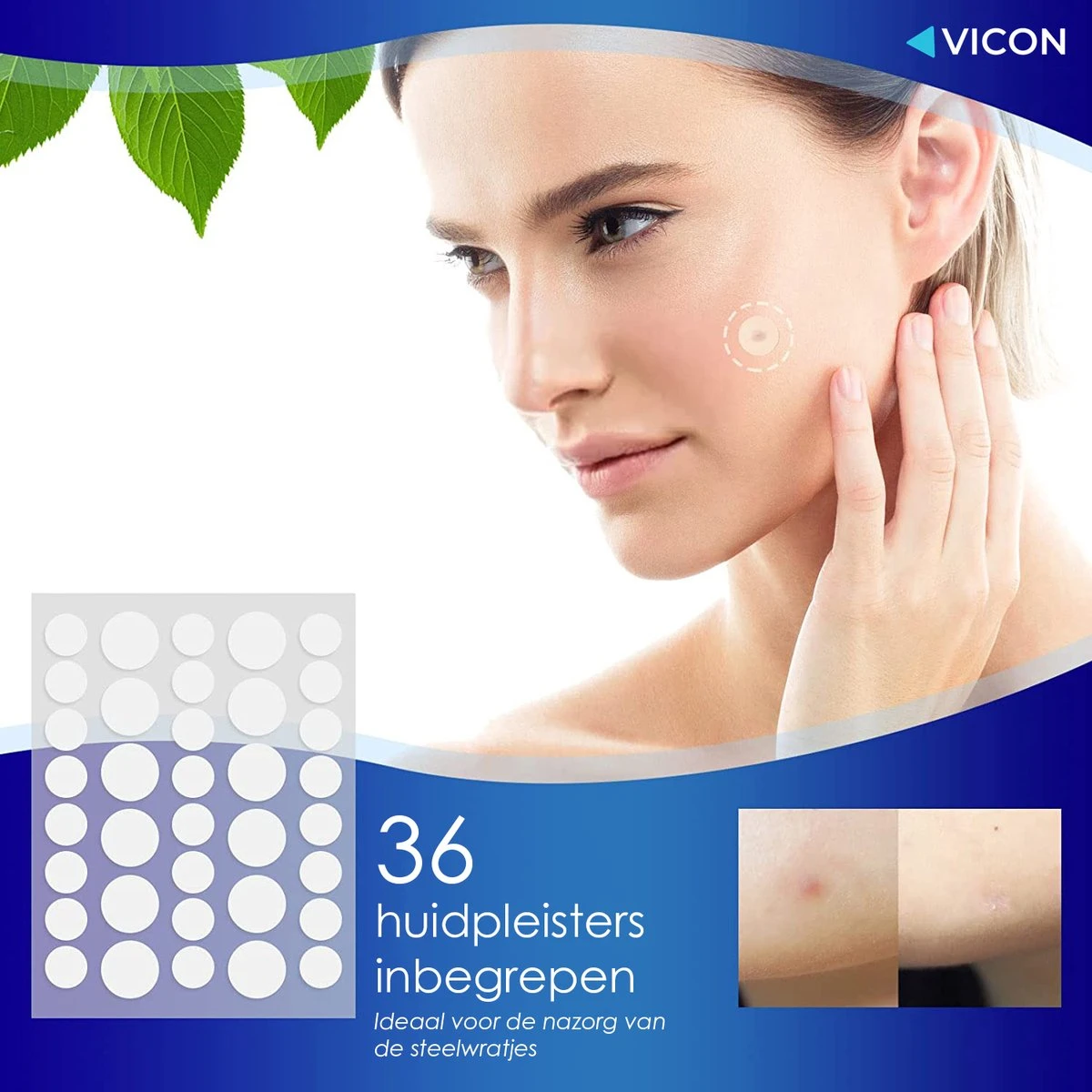 Vicon Steelwratjes Verwijderen - 2-5MM - Pijnloos En Snel - Incl. Huidpleisters - Skin Tags Verwijderen - Wrattenverwijderaar - Steelwratten Pen 8 Vicon Steelwratjes Verwijderen - 2-5MM - Pijnloos En Snel - Incl. Huidpleisters - Skin Tags Verwijderen - Wrattenverwijderaar - Steelwratten Pen - Afbeelding 6