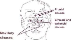 Neti Pot - Keramiek - 25 Gram Zout - 17.5x7 - 150ml 7 Neti Pot - Keramiek - 25 Gram Zout - 17.5x7 - 150ml -Zelfzorg Winkel 1200x665