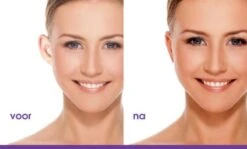 OTOSTICK Oorcorrectie Stickers / Flapoorstickers - Helpt Bij Flaporen - 8 Stuks -Zelfzorg Winkel 1200x722