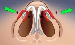 NoseWings® - (anti Snurk) Neusspreiders Voor Verbeterde Neusademhaling Bij Snurken, Sporten Of Yoga - Herbruikbaar -Zelfzorg Winkel 1200x731 1