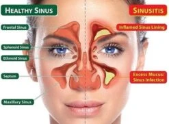 Neti Pot - Plastic - Incl. 25 Gram Himalayazout -Zelfzorg Winkel 1200x881