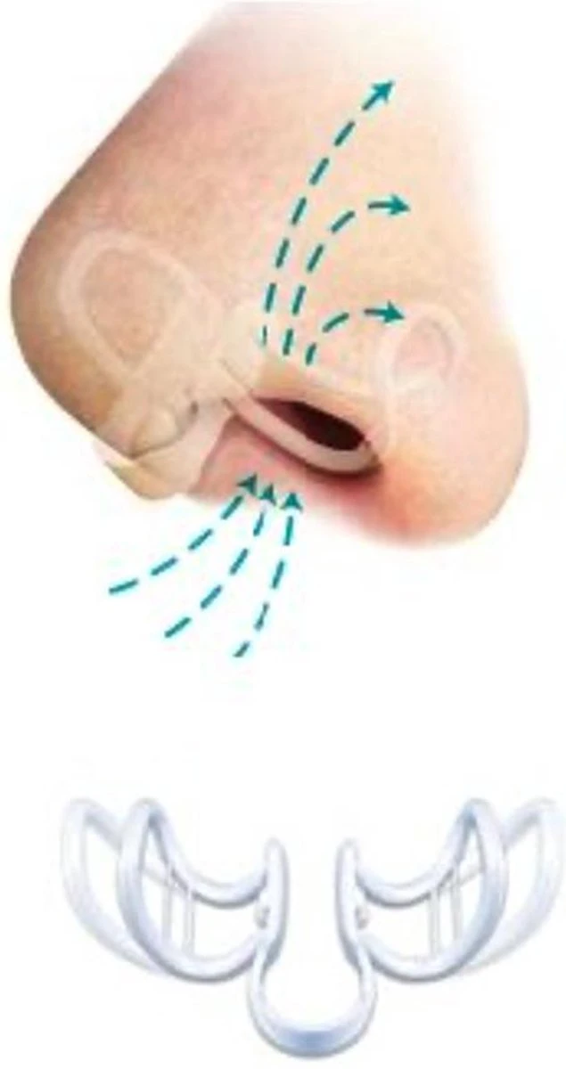 Sport Breathe Aid |Neusspreider | 2 Stuks | One Size Fits All 4 Sport Breathe Aid |Neusspreider | 2 Stuks | One Size Fits All - Afbeelding 2