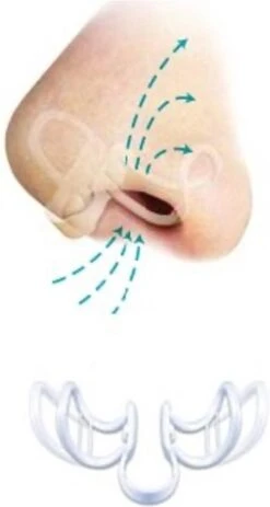 SleepRight Nasal Breathe Aid - Neusspreider - 3 Stuks -Zelfzorg Winkel 640x1200 2