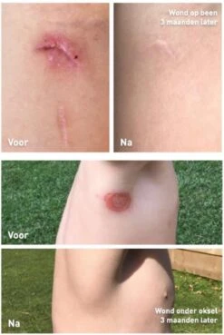 Staudt Littekencrème 40ML -Zelfzorg Winkel 804x1200 1