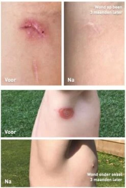 Staudt Littekencrème -Zelfzorg Winkel 806x1200