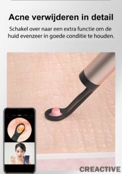 Creactive® - BeBird® T15 - Oorreiniger Otoscoop Oorsmeer En Acne Verwijderaar - Oorreiniging Met Camera, Lamp En App Op Smartphone - Veilig, Comfortabel, Makkelijk En Zuiver - Oorspuit Spiraalvormig 24 Creactive® - BeBird® T15 - Oorreiniger Otoscoop Oorsmeer En Acne Verwijderaar - Oorreiniging Met Camera, Lamp En App Op Smartphone - Veilig, Comfortabel, Makkelijk En Zuiver - Oorspuit Spiraalvormig -Zelfzorg Winkel 843x1200
