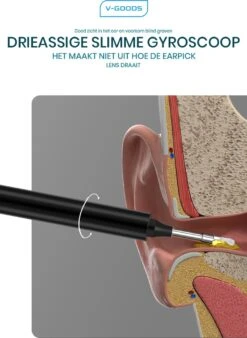 V-Goods Professionele Oorsmeer Verwijderaar - Oorreiniging - + 8 GRATIS Opzetstukjes - Oorreiniger - Met HD-Camera, Licht En App -Zelfzorg Winkel 876x1200 2