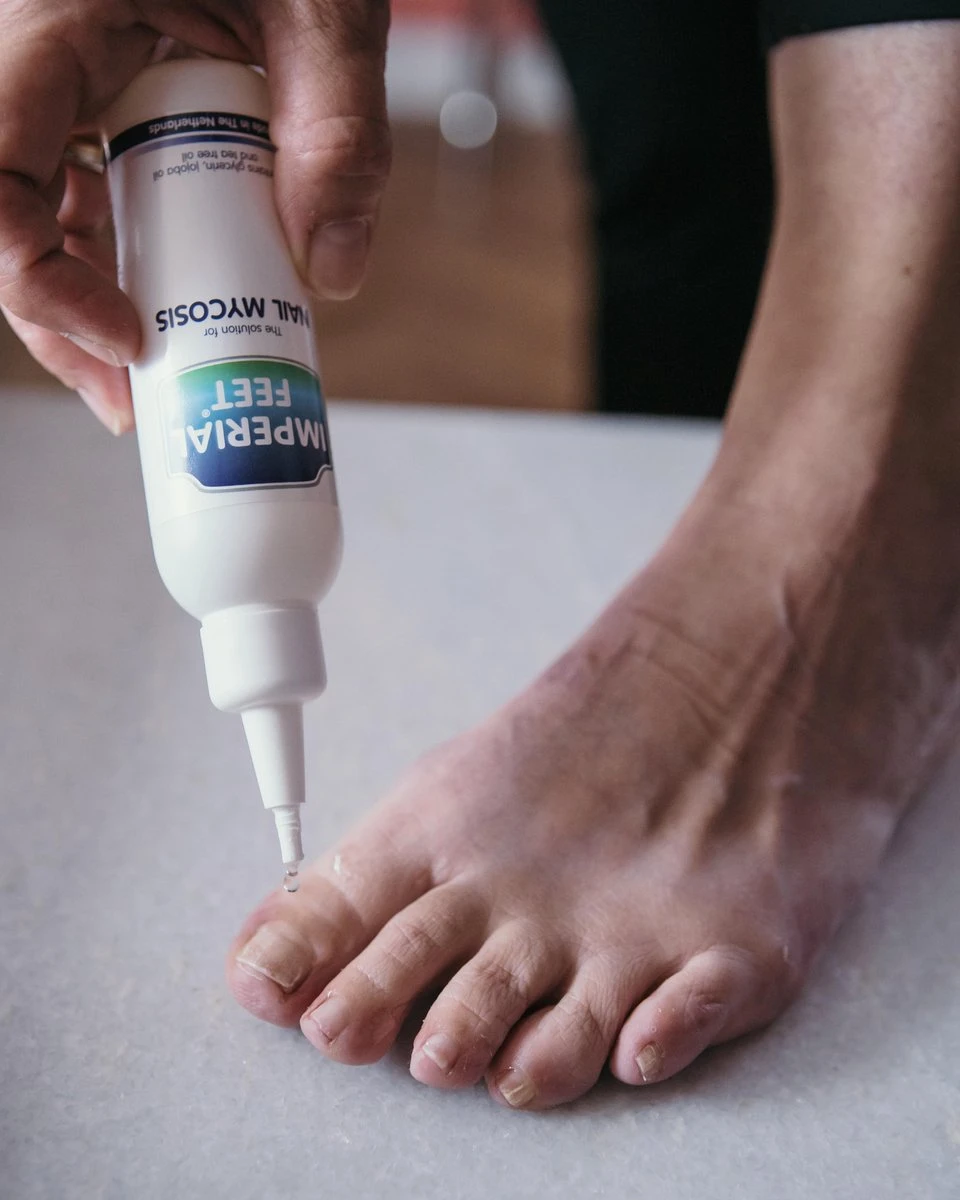 Imperial Feet – Verzorging Van Kalknagels En Schimmelnagels - Kalknagelbehandeling - XL 75ML 7 Imperial Feet – Verzorging Van Kalknagels En Schimmelnagels - Kalknagelbehandeling - XL 75ML - Afbeelding 5